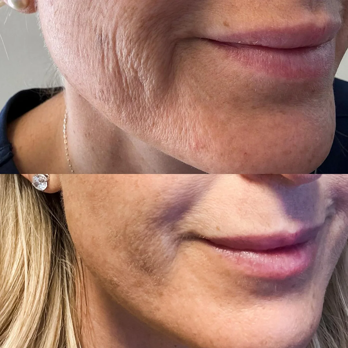 Brandy holding botox vials